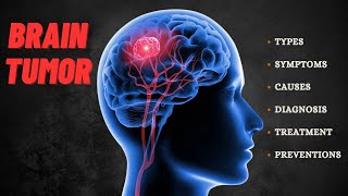 What Happens In Brain Tumor | Symptoms | Causes | treatment | Urdu/Hindi | 3D Animation