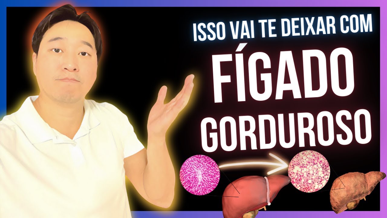 ISSO VAI TE DEIXAR COM GORDURA NO FÍGADO.