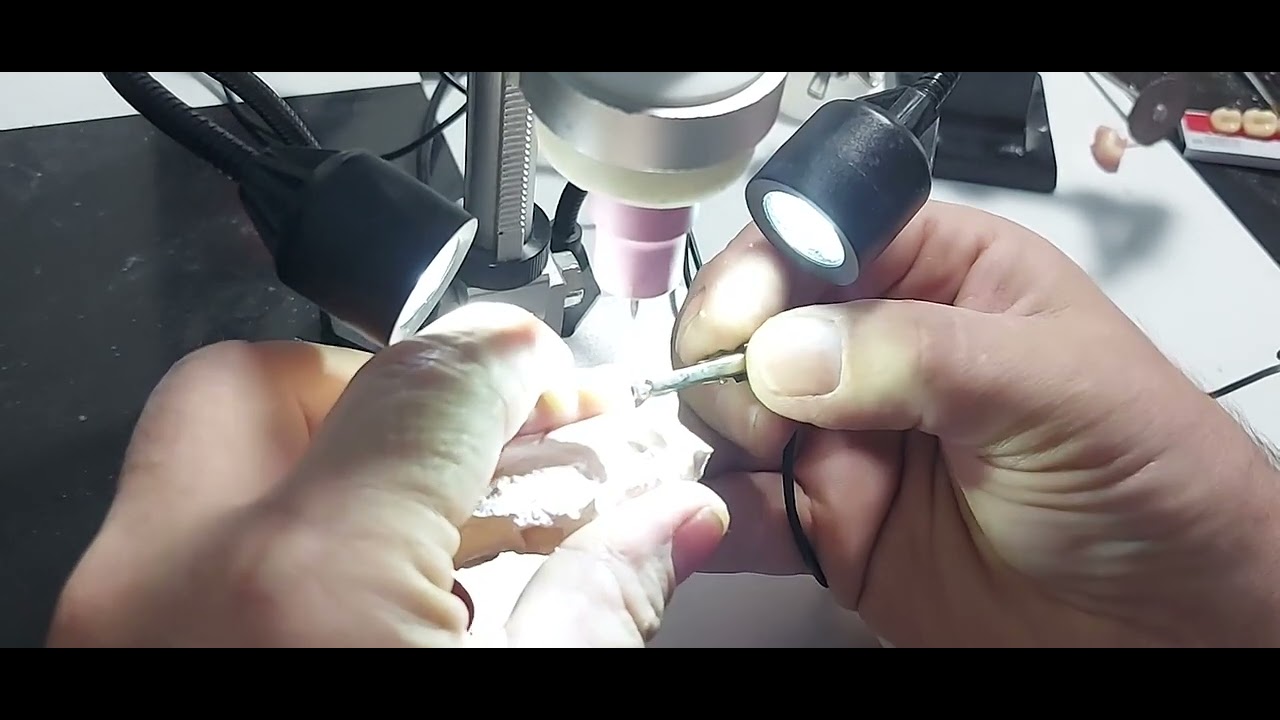 conserto de uma Protocolo Dentário com solda TIG