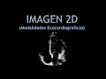 2D ECO + Optimizacion de las imagenes! (Ecocardiografia)