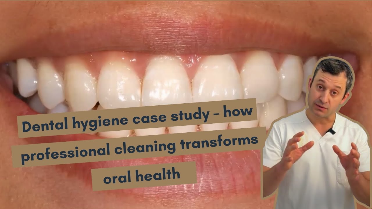Dental Hygiene Case Study YouTube dental-hygiene-case-study-youtube