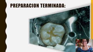 preparación y restauración para clase I (amalgama)