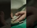 He saved her.