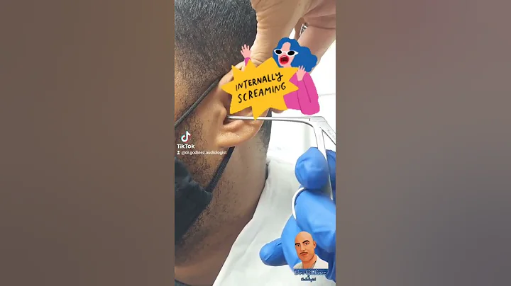 Ear cleaning (removal of Q-tip or swab)