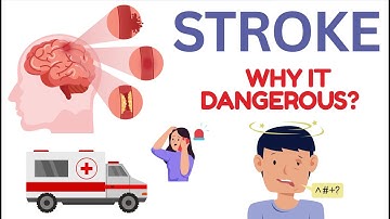 "Symptomen van een beroerte die iedereen moet kennen! 🧠⏱️ #youtube