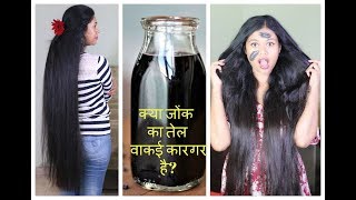 Hi everyone, can leeches (jonk / जोंक) really help in hair
growth and cure baldness? leech therapy to baldness, alopecia other
related problems...