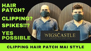 Hair Patch System | Hair Patch Clipping System For Men In Bangalore | 9577295779, 9739889849