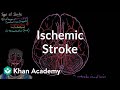 Ischemic stroke | Circulatory System and Disease | NCLEX-RN | Khan Academy