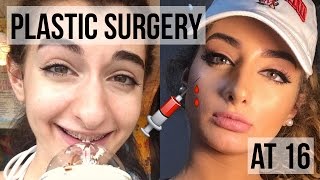 MY PLASTIC SURGERY STORY: NOSE JOB AT 16