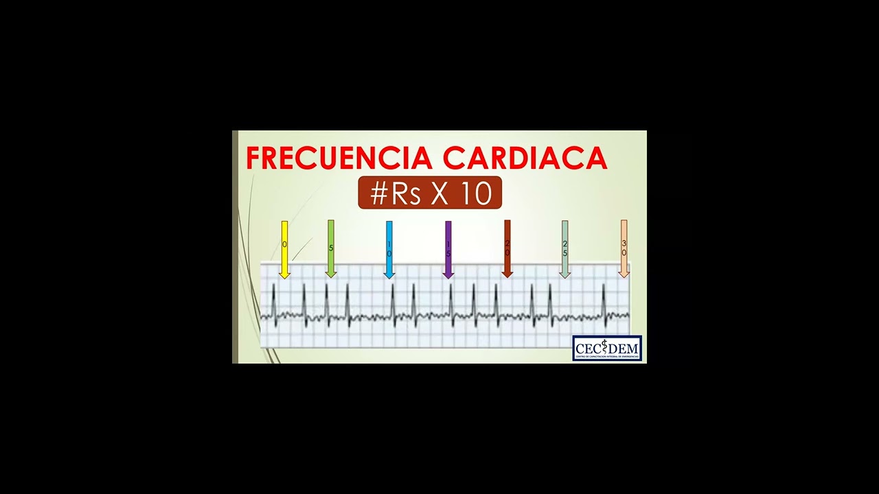 Electrocardiograma básico Alumnos CECIDEM