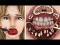 Asmrremove parasites from campers mouthtrypophobia cautious entry  
