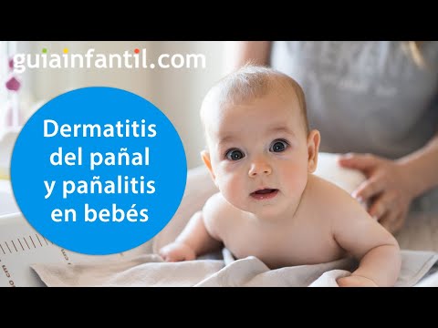 Cuál es la mejor crema para la dermatitis del pañal? ✓