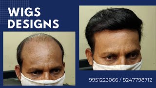 Hair Bonding in Bangalore | Hyderabad | 8247798712 | 9951223066