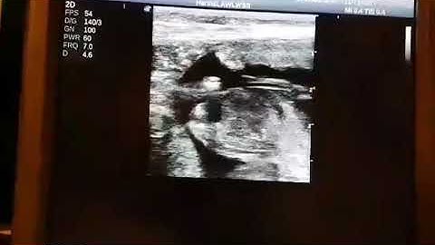 Pupscan Scanning 35 days
