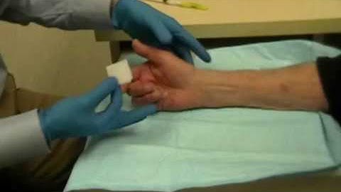 Right trigger thumb injection