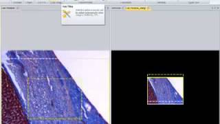 Use Live Tiling to create large mosaic images in Image-Pro Insight Software