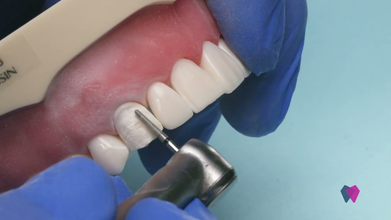 How NOT to Wreck the Neighbor Tooth (Crown Prep Tips Inside)