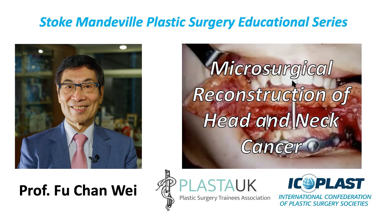 Fu Chan Wei: Microsurgical Reconstruction of Head and Neck Cancer 