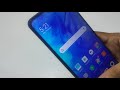 How make direct call in redmi 9iall redmi phones direct call kaise kare