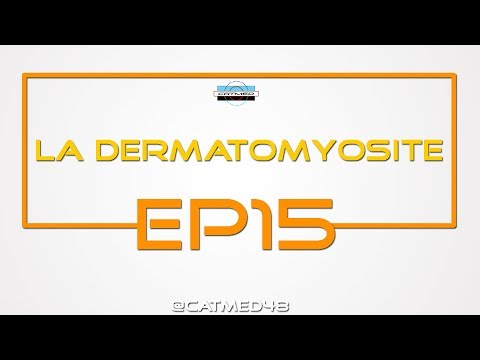 Vidéo: Dermatomyosite - Symptômes, Traitement, Formes, Stades, Diagnostic