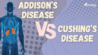 Addison's Disease vs Cushing's Disease (Nursing)