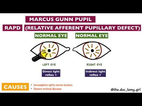 Video: Pupillary Response - Verklarende Medische Termen