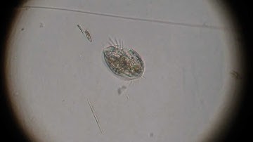 Unidentified hypotrich (Euplotes)