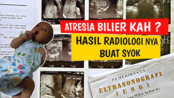 KUNING PADA BAYI - KUNING SAMPAI 3 BULAN LEBIH PART 2