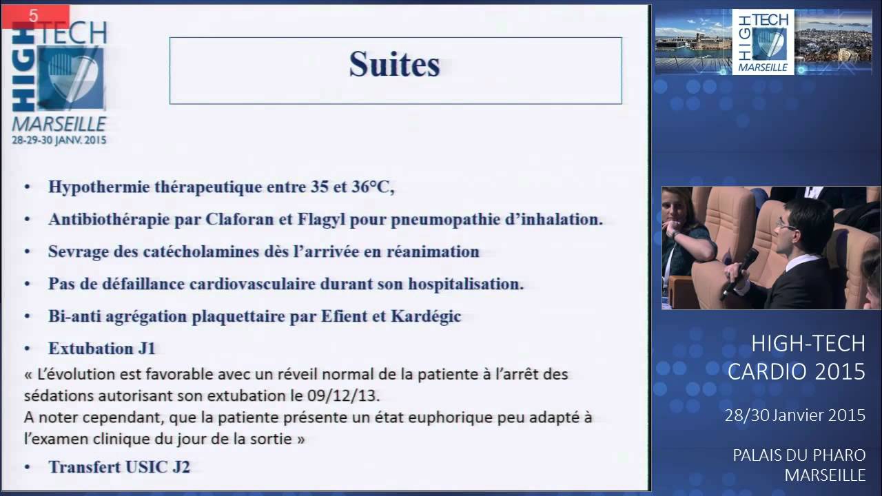 Quelques histoires vraiment singulières camera iphone 8 plus apk