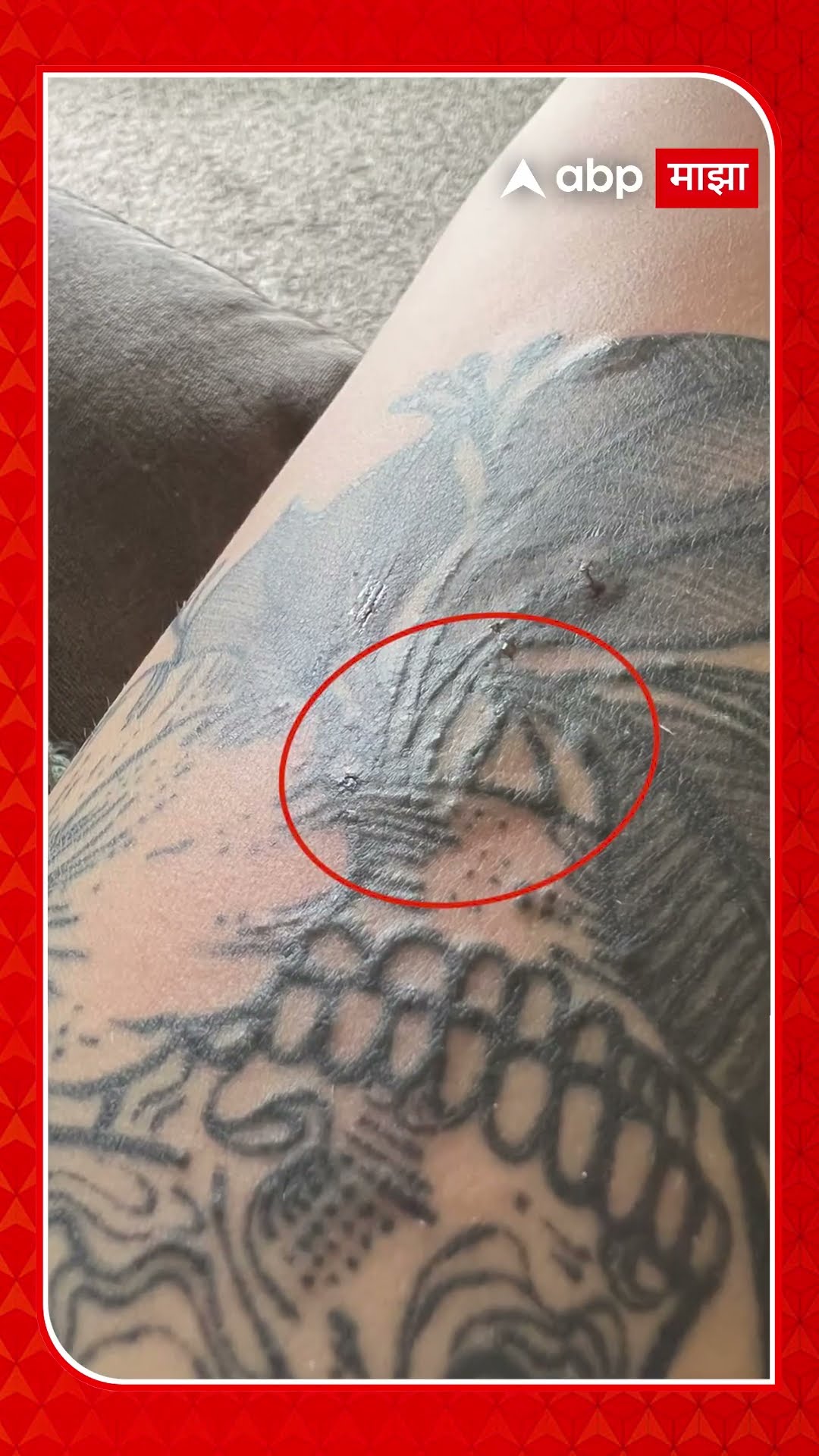 Tattoo Blood Cancer | टॅटूमुळे ब्लड कॅन्सरचा धोका: शाईमध्ये असतात 10 धोकादायक केमिकल्स