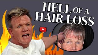 Gordon Ramsay's Hair Transplant: Before and After Revealed! [How Did He Do It?]