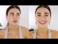 5 MIN EVERYDAY MAKEUP TUTORIAL // HIDING MY ACNE