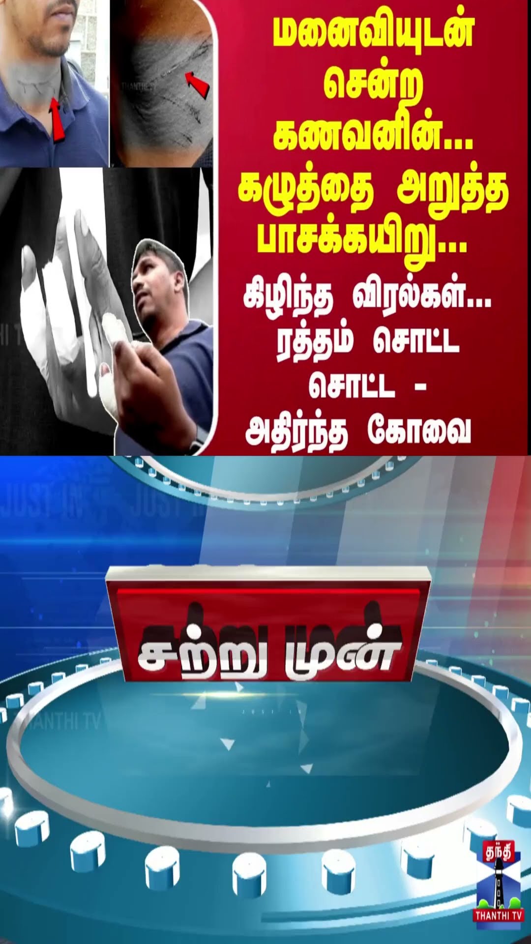 மனைவியுடன் சென்ற கணவனின்... கழுத்தை அறுத்த பாசக்கயிறு... ரத்தம் சொட்ட சொட்ட - அதிர்ந்த கோவை