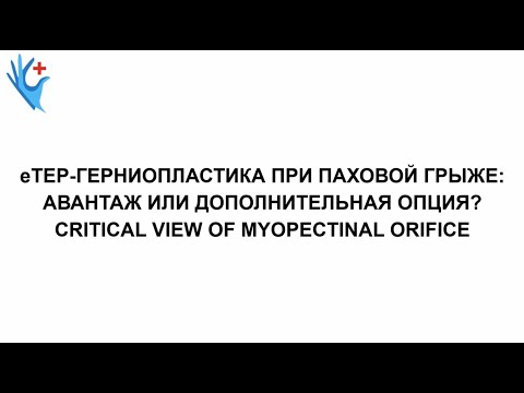 Паховая eTEP-герниопластика: авантаж или дополнительная опция?