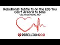 Rebellion21: Subtle Ts on the ECG You Can't Afford to Miss via Amal Mattu, MD