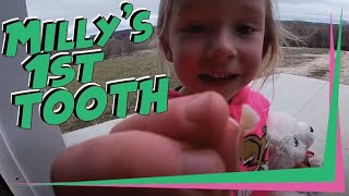 Millys Losing Her 1St Tooth