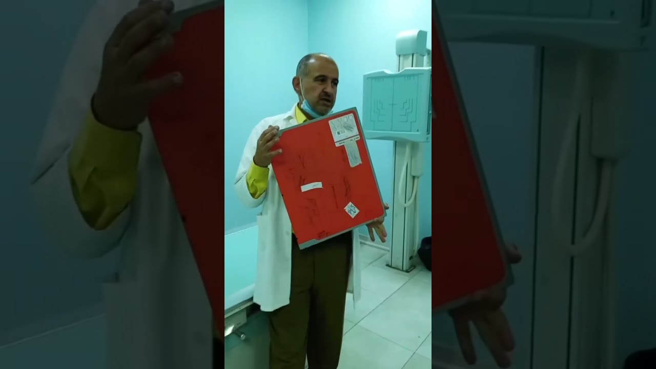 اجزاء جهاز الاشعة وكيفية التعامل مع الجهاز وتطور التصوير الشعاعي التقليديه X-Ray الى الرقمي DR,CR