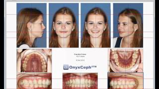 Image Import OnyxCeph³