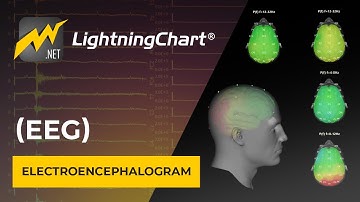 Visualizing an Electroencephalogram (EEG) chart with .NET charts