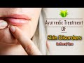Skin diseases  its ayurvedic management by  vd neeraj vyas sir