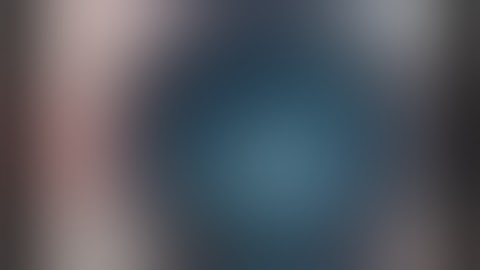 Cataract Surgery in Intumescent White Cataract With Intra Ocular Lens Implantation Unedited HD