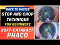 Phaco basics stop and chop technique in soft cataract for beginners  dr deepak megur