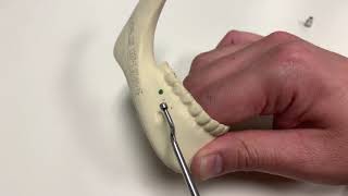 Bone Tack Remover