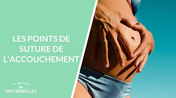 Comment nettoyer des points de suture ?