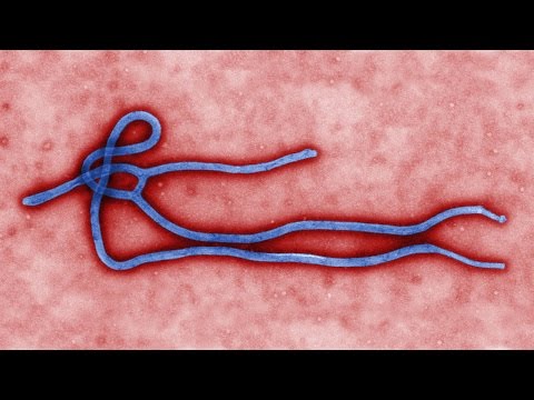 Video: 25 Strangest Diseases In The World That Scientists Still Cannot Explain - Alternative View