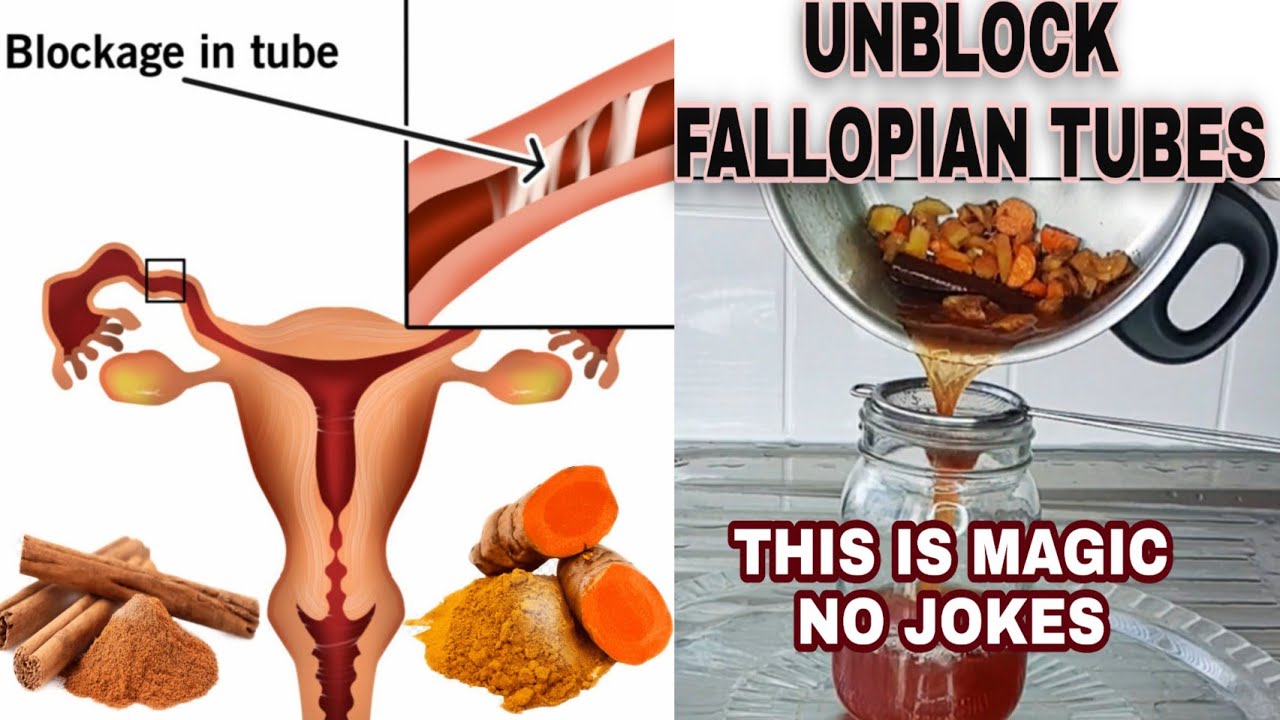 How To UNBLOCK FALLOPIAN TUBES Naturally Conceive Faster Effective How To UNBLOCK FALLOPIAN TUBES Naturally Conceive Faster Effective