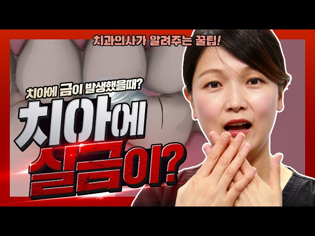 치아에 금/균열이 갔을때? 치과의사가 알려주는 꿀팁 | 강남 아름드리치과