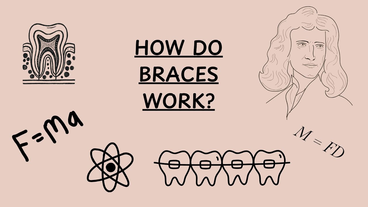 How do braces work? - YouTube