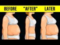 Weight Gain After Weight Loss? Lose Weight FOR GOOD