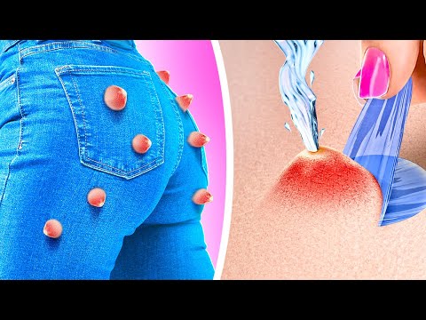 HOW TO REMOVE PIMPLES! SMART BEAUTY HACKS YOU SHOULD KNOW